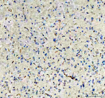 IHC testing of FFPE rat brain tissue with Otoferlin antibody. HIER: Boil the paraffin sections in pH 8 EDTA buffer for 20 minutes and allow to cool prior to staining.