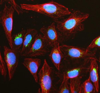 Immunofluorescent staining of FFPE human U-2 OS cells with Smac antibody (green), Alpha Tubulin mAb (red) and DAPI nuclear stain (blue). HIER: steam section in pH6 citrate buffer for 20 min.