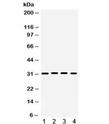 Western blot testing of 1) rat brain, 2) rat heart, 3) mouse heart and 4) human 22RV1 lysate with KChIP2 antibody. Expected molecular weight ~31 kDa.