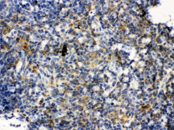IHC testing of FFPE mouse thymus with TLR7 antibody. HIER: Boil the paraffin sections in pH 6, 10mM citrate buffer for 20 minutes and allow to cool prior to staining.