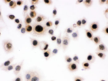 ICC testing of human SMMC-7721 cells with Daxx antibody.