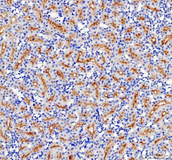 IHC staining of FFPE rat kidney tissue with ABCG2 antibody, HRP-secondary and DAB substrate. HIER: boil tissue sections in pH8 EDTA for 20 min and allow to cool before testing.