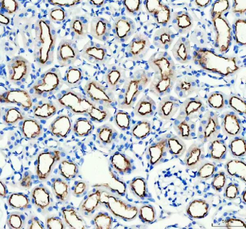 IHC staining of FFPE mouse kidney tissue with ABCG2 antibody, HRP-secondary and DAB substrate. HIER: boil tissue sections in pH8 EDTA for 20 min and allow to cool before testing.