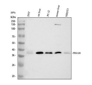 PRKAB1 Antibody Human, Rat and Mouse WB. Western blot demonstrates detection of PRKAB1 in human 293T cells, rat liver and PC-12 cell lysates, and mouse liver and NIH3T3 cell lysates. A prominent immunoreactive band is observed at approximately 38 kDa in all samples, slightly above the predicted molecular weight of approximately 30 kDa, which is consistent with the reduced electrophoretic mobility frequently reported for AMPK beta 1. An additional high molecular weight band is visible in the mouse liver sample, which may represent a modified protein species or a protein complex. This PRKAB1 Antibody is suitable for studies of protein kinase AMP-activated non-catalytic subunit beta 1, AMPK signaling, and cellular energy metabolism across human, rat, and mouse samples.