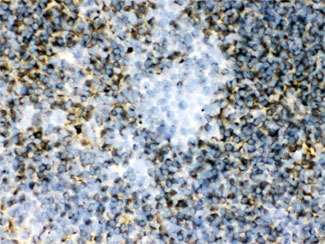 IHC-F: TGM2 antibody testing of mouse spleen tissue