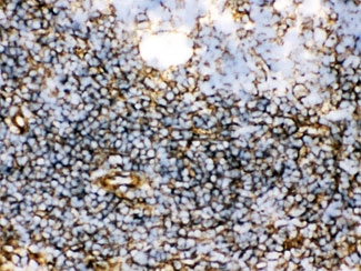 IHC-F: TGM2 antibody testing of rat spleen tissue