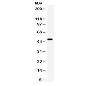 CD27 Antibody for WB. Western blot analysis of CD27 / TNFRSF7 expression in human HeLa cell lysate using CD27 Antibody. Lane 1: HeLa cell lysate. A band is detected at approximately 45â50 kDa, consistent with glycosylated CD27, noting a lower predicted molecular weight of approximately 29 kDa for the core protein. CD27 is a glycosylated receptor, and the higher apparent molecular weight reflects N-linked glycosylation that can influence migration on SDS-PAGE. The observed signal may reflect low-level or context-dependent expression and supports evaluation of CD27 distribution in studies of lymphoid tissue architecture.