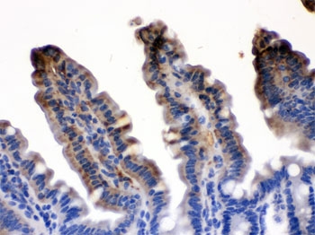 FABP2 Antibody Mouse Intestine IHC. Immunohistochemistry testing of FFPE mouse intestine with FABP2 antibody. HIER: Boil the paraffin sections in pH 6, 10mM citrate buffer for 20 minutes and allow to cool prior to testing.