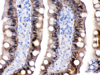 FABP2 Antibody Rat Intestine IHC. Immunohistochemistry testing of FFPE rat intestine with FABP2 antibody. HIER: Boil the paraffin sections in pH 6, 10mM citrate buffer for 20 minutes and allow to cool prior to testing.