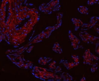 Collagen I Antibody Human Placenta IF. Immunofluorescent staining of FFPE human placental tissue with Collagen I antibody revealed strong extracellular and stromal staining consistent with the distribution of type I collagen within connective tissue compartments. Collagen I, composed primarily of COL1A1 and COL1A2 chains, is the most abundant fibrillar collagen in the extracellular matrix and provides structural support, tensile strength, and tissue integrity. Red fluorescence indicates Collagen I expression, while nuclei are counterstained with DAPI (blue). The prominent extracellular staining pattern observed in placental connective tissues is consistent with the essential role of collagen I in matrix organization, tissue architecture, and cell-matrix interactions. Heat-induced epitope retrieval was performed by steaming sections in pH 8 EDTA buffer for 20 minutes prior to immunostaining. These results support the utility of Collagen I Antibody for studies of extracellular matrix biology, tissue remodeling, fibrosis, and connective tissue development.