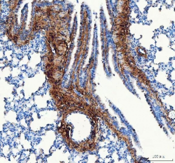 Collagen I Antibody / Extracellular Matrix Protein Rat Lung IHC. Immunohistochemical staining of FFPE rat lung tissue using Collagen I Antibody / Extracellular Matrix Protein. Collagen I expression is observed predominantly within the connective tissue surrounding bronchioles and blood vessels, consistent with its role in maintaining pulmonary extracellular matrix architecture and providing structural support to the respiratory tract. Heat-induced epitope retrieval was performed by boiling tissue sections in pH 8 EDTA for 20 minutes followed by cooling prior to immunostaining.