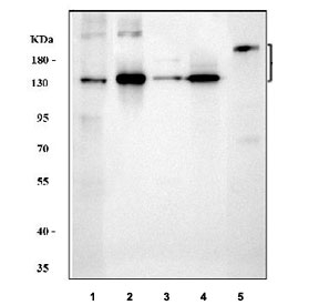 Collagen I Antibody / Extracellular Matrix Protein Human, Mouse and Rat WB. Western blot analysis of 1) human placenta, 2) rat skin, 3) rat lung, 4) mouse skin, and 5) mouse NIH/3T3 cell lysates using Collagen I Antibody / Extracellular Matrix Protein. Specific immunoreactive bands are detected corresponding to both the Collagen I precursor (approximately 140-210 kDa) and the mature processed form (approximately 70-90 kDa), demonstrating detection of COL1A1 across multiple human, rat, and mouse tissues and cell lysates.