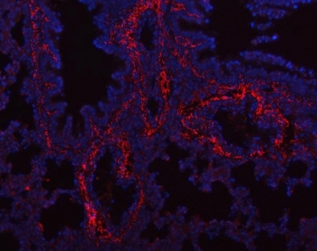 Collagen I Antibody Rat Lung IF. Immunofluorescent staining of FFPE rat lung tissue with Collagen I antibody revealed strong extracellular staining associated with peribronchial, perivascular, and interstitial connective tissue structures, consistent with the distribution of type I collagen within the pulmonary extracellular matrix. Collagen I, composed primarily of COL1A1 and COL1A2 chains, is the most abundant fibrillar collagen in vertebrate tissues and provides structural support, tensile strength, and matrix integrity. Red fluorescence indicates Collagen I expression, while nuclei are counterstained with DAPI (blue). The prominent staining observed within matrix-rich regions of the lung is consistent with the role of collagen I in maintaining tissue architecture and regulating extracellular matrix remodeling. Heat-induced epitope retrieval was performed by steaming sections in pH 8 EDTA buffer for 20 minutes prior to immunostaining. These results support the utility of Collagen I Antibody for studies of extracellular matrix biology, pulmonary fibrosis, tissue remodeling, and connective tissue development.