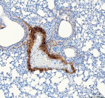 Collagen I Antibody / Extracellular Matrix Protein Mouse Lung IHC. Immunohistochemical staining of FFPE mouse lung tissue using Collagen I Antibody / Extracellular Matrix Protein. Collagen I expression is observed predominantly within the connective tissue surrounding bronchioles and blood vessels, consistent with its role in maintaining pulmonary extracellular matrix architecture and providing structural support to the lung. Heat-induced epitope retrieval was performed by boiling tissue sections in pH 8 EDTA for 20 minutes followed by cooling prior to immunostaining.