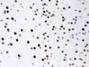 IHC testing of FFPE mouse brain with MEF2A antibody. HIER: Boil the paraffin sections in pH 6, 10mM citrate buffer for 20 minutes and allow to cool prior to testing.