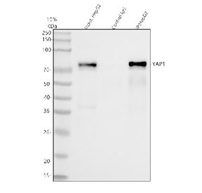 YAP1 Antibody IP. Immunoprecipitation analysis of YAP1 was performed using 500 ug of human HepG2 whole cell lysate and 2 ug of YAP1 antibody. YAP1, also known as Yes Associated Protein 1, is a transcriptional coactivator and major Hippo pathway effector involved in regulating cell proliferation, tissue growth, and tumor progression. Immunoprecipitated proteins were analyzed by western blot, revealing a specific YAP1 band at approximately 70 kDa. Lane 1: input HepG2 lysate. Lane 2: control rabbit IgG immunoprecipitate. Lane 3: YAP1 antibody immunoprecipitate. These results demonstrate the ability of YAP1 Antibody to efficiently capture endogenous YAP1 protein and support its utility for studies of Hippo signaling and protein interaction networks.
