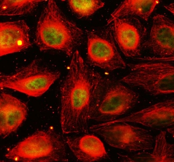 YAP1 Antibody IF. Immunofluorescent staining of FFPE human U-2 OS cells demonstrates YAP1 expression using a YAP1 antibody (green) and Beta Tubulin mAb (red), which highlights the cytoskeletal network. YAP1, also known as Yes Associated Protein 1, exhibits predominantly nuclear and cytoplasmic localization consistent with its function as a Hippo pathway effector and transcriptional coactivator. Heat induced epitope retrieval was performed by steaming sections in pH6 citrate buffer for 20 minutes prior to staining. This immunofluorescence image illustrates the intracellular distribution of YAP1 relative to the microtubule cytoskeleton and supports the use of this antibody for studies of mechanotransduction, tissue growth, and cancer signaling.