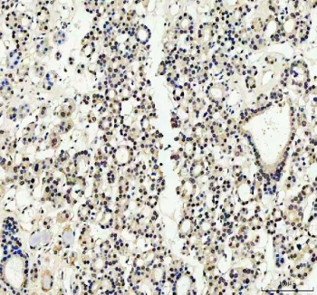 YAP1 Antibody Human Thyroid IHC. Immunohistochemical staining of FFPE human thyroid tissue demonstrates YAP1 expression using a YAP1 antibody. YAP1, also known as Yes Associated Protein 1, is a transcriptional coactivator and central Hippo pathway effector that regulates cell proliferation, differentiation, and tissue homeostasis. Predominantly nuclear staining is observed in thyroid follicular epithelial cells, consistent with the role of YAP1 in controlling growth and regenerative signaling. Heat induced epitope retrieval was performed by boiling tissue sections in pH8 EDTA buffer for 20 minutes followed by cooling prior to staining. These findings support the utility of YAP1 Antibody for investigating Hippo pathway signaling and epithelial biology in normal and neoplastic thyroid tissues.
