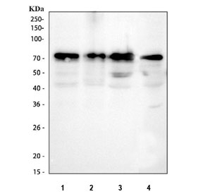YAP1 Antibody Human and Rat WB. Western blot analysis of YAP1 expression using a YAP1 antibody. Lane 1: human HepG2 cell lysate. Lane 2: human RT4 cell lysate. Lane 3: human PC-3 cell lysate. Lane 4: mouse RM1 cell lysate. YAP1, also known as Yes Associated Protein 1, is a transcriptional coactivator and major Hippo pathway effector involved in cell proliferation, tissue growth, and tumorigenesis. A strong band is detected in all lysates at approximately 65 to 70 kDa, consistent with the commonly observed electrophoretic mobility of YAP1. Although the predicted molecular weight is approximately 54 kDa, post translational modifications and phosphorylation are known to cause slower migration in SDS PAGE. These results support the utility of YAP1 Antibody for detecting endogenous YAP1 across multiple cell types and species.