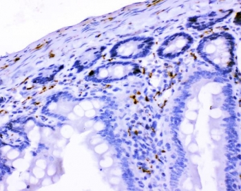 IHC testing of FFPE rat intestinal tissue with VIP antibody. HIER: Boil the paraffin sections in pH8 EDTA buffer for 20 minutes and allow to cool prior to testing.