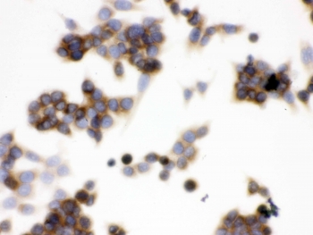 ICC testing of FFPE human LOVO cells with TCP1 epsilon antibody. HIER: Boil the paraffin sections in pH 6, 10mM citrate buffer for 20 minutes and allow to cool prior to testing.