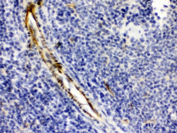 Alpha A Crystallin Antibody Mouse Spleen IHC. IHC staining of FFPE mouse spleen with Alpha A Crystallin antibody demonstrated cytoplasmic staining in scattered splenic cells. Alpha A Crystallin (CRYAA) is a small heat shock protein and ATP-independent molecular chaperone that protects cells from protein aggregation, oxidative stress, and apoptosis while maintaining protein homeostasis. Although best known as a major structural protein of the ocular lens, Alpha A Crystallin is also expressed in selected non-lenticular tissues where it contributes to cellular stress responses and cytoprotection. HIER was performed by boiling tissue sections in pH 6, 10 mM citrate buffer for 20 minutes followed by cooling prior to staining. These results support the utility of Alpha A Crystallin Antibody for studies of molecular chaperone function, protein homeostasis, and cellular stress responses.
