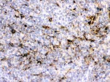 Alpha A Crystallin Antibody Rat Spleen IHC. IHC staining of FFPE rat spleen with Alpha A Crystallin antibody demonstrated cytoplasmic staining in scattered splenic cells. Alpha A Crystallin (CRYAA) is a small heat shock protein and ATP-independent molecular chaperone that protects cells from protein aggregation, oxidative stress, and apoptosis while maintaining protein homeostasis. Although predominantly expressed in the ocular lens, Alpha A Crystallin is also present in selected non-lenticular tissues where it contributes to cellular stress responses and cytoprotection. HIER was performed by boiling tissue sections in pH 6, 10 mM citrate buffer for 20 minutes followed by cooling prior to staining. These results support the utility of Alpha A Crystallin Antibody for studies of molecular chaperone function, protein homeostasis, and cellular stress responses.
