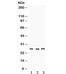 Western blot testing of 1) rat brain, 2) mouse testis and 3) human SW620 lysate with SIP antibody. Expected/observed molecular weight ~26 kDa.