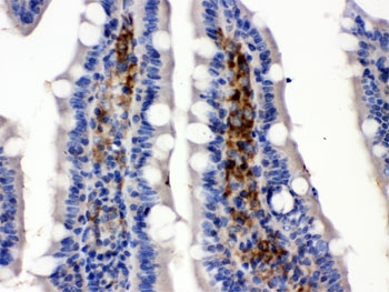 SLC2A5 Antibody Rat Intestine IHC. Immunohistochemical staining of FFPE rat intestine demonstrates SLC2A5 expression using an SLC2A5 antibody. SLC2A5, also known as GLUT5 and Sugar Transport Protein, is a facilitative transporter that preferentially mediates fructose uptake and plays a central role in intestinal carbohydrate absorption. Predominantly apical and cytoplasmic staining is observed in intestinal epithelial cells, consistent with the localization of GLUT5 in enterocytes responsible for dietary fructose transport. Heat induced epitope retrieval was performed by boiling tissue sections in pH 6 10 mM citrate buffer for 20 minutes followed by cooling prior to staining. These results support the utility of SLC2A5 Antibody for studies of fructose transport, nutrient absorption, and metabolic regulation.