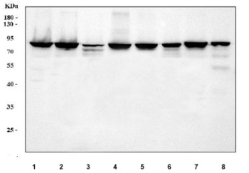 Western blot testing of 1) human HeLa, 2) human MCF7, 3) human Jurkat, 4) human MDA-MB-453, 5) rat brain, 6) rat liver, 7) mouses brain and 8) mouse liver tissue lysate with AFG3L2 antibody. Expected molecular weight ~89 kDa.