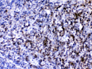 IHC testing of FFPE mouse lymph node with anti-Cd2 antibody. HIER: Boil the paraffin sections in pH 6, 10mM citrate buffer for 20 minutes and allow to cool prior to testing.