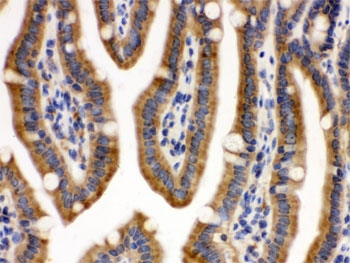 CDCP1 Antibody / SIMA135 immunohistochemistry analysis of mouse intestine tissue. Formalin-fixed paraffin-embedded mouse intestine stained with CDCP1 Antibody / SIMA135. HRP-DAB brown chromogenic staining highlights membranous signal along intestinal epithelial cells lining the villi, consistent with the expected cell surface localization of CDCP1 / CD318. HIER: boil the paraffin sections in pH 6, 10mM citrate buffer for 20 minutes and allow to cool prior to testing.
