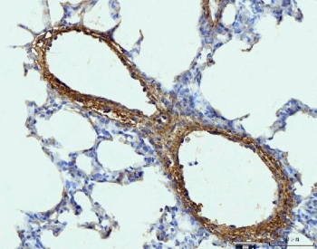 Collagen I Antibody Rat Lung IHC. IHC staining of FFPE rat lung tissue with Collagen I antibody demonstrated strong extracellular staining associated with vascular walls, perivascular connective tissue, and interstitial matrix components, consistent with the distribution of type I collagen within pulmonary supporting structures. Collagen I is the most abundant fibrillar collagen in vertebrate tissues and provides tensile strength, structural integrity, and mechanical support to connective tissues. The prominent staining observed surrounding blood vessels and within stromal regions highlights the role of collagen I in maintaining lung architecture and extracellular matrix organization. Heat-induced epitope retrieval was performed by boiling tissue sections in pH 8 EDTA buffer for 20 minutes and allowing them to cool before immunostaining. These results support the utility of Collagen I Antibody for studies of extracellular matrix biology, pulmonary fibrosis, tissue remodeling, and connective tissue development.
