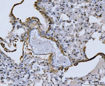Collagen I Antibody Mouse Lung IHC. IHC staining of FFPE mouse lung tissue with Collagen I antibody demonstrated prominent extracellular staining along alveolar septa, connective tissue interfaces, and matrix-rich stromal regions, consistent with the distribution of type I collagen within the pulmonary extracellular matrix. Collagen I is the principal fibrillar collagen responsible for providing tensile strength and structural support to connective tissues throughout the body. The staining pattern highlights collagen-rich regions that contribute to maintenance of alveolar architecture and tissue integrity. Heat-induced epitope retrieval was performed by boiling tissue sections in pH 8 EDTA buffer for 20 minutes and allowing them to cool before immunostaining. These results support the utility of Collagen I Antibody for studies of extracellular matrix biology, pulmonary fibrosis, tissue remodeling, and connective tissue development.