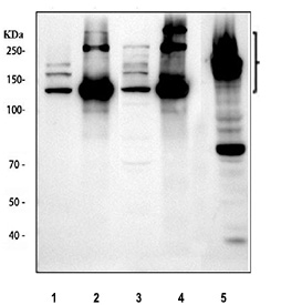 Collagen I Antibody Rodent Tissues and Fibroblasts WB. Western blot analysis of Collagen I expression was performed using anti-Collagen I antibody in rodent tissue and cell lysates. Lane 1: rat lung lysate. Lane 2: rat skin lysate. Lane 3: mouse lung lysate. Lane 4: mouse skin lysate. Lane 5: mouse NIH 3T3 cell lysate. Collagen I is the major fibrillar collagen of connective tissues and is synthesized as a high-molecular-weight procollagen precursor that undergoes proteolytic processing to generate mature collagen chains. Prominent immunoreactive bands are detected between approximately 140-210 kDa, corresponding to precursor procollagen forms, with additional bands observed in the expected mature collagen range of approximately 70-90 kDa. Strong expression in skin tissues and NIH 3T3 fibroblasts is consistent with the abundant production of type I collagen by fibroblasts and connective tissue cells. These results support the utility of Collagen I Antibody for studies of extracellular matrix biology, fibrosis, connective tissue development, wound healing, and tissue remodeling.