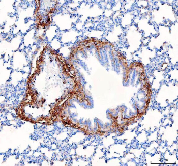 Collagen I Antibody Rat Lung IHC. IHC staining of FFPE rat lung tissue with Collagen I antibody demonstrated strong extracellular staining surrounding bronchiolar structures, vascular walls, and connective tissue-rich stromal regions, consistent with the distribution of type I collagen within the pulmonary extracellular matrix. Collagen I is the principal fibrillar collagen responsible for providing tensile strength, structural support, and mechanical stability to connective tissues. The prominent staining observed around airway and perivascular structures highlights the role of collagen I in maintaining lung architecture and extracellular matrix organization. Immunostaining was performed using an HRP-conjugated secondary antibody and DAB chromogen. Heat-induced epitope retrieval was achieved by boiling tissue sections in pH 8 EDTA buffer for 20 minutes and allowing them to cool before testing. These results support the utility of Collagen I Antibody for studies of extracellular matrix biology, pulmonary fibrosis, tissue remodeling, and connective tissue development.