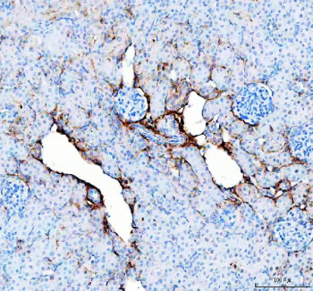 Collagen I Antibody Rat Kidney IHC. IHC staining of FFPE rat kidney tissue with Collagen I antibody demonstrated strong extracellular staining associated with vascular structures, interstitial connective tissue, and basement membrane-adjacent stromal regions, consistent with the distribution of type I collagen within the renal extracellular matrix. Collagen I is the major fibrillar collagen responsible for providing structural support and tensile strength to connective tissues and plays an important role in maintaining tissue architecture. The staining pattern observed highlights matrix-rich regions that contribute to renal structural integrity and extracellular matrix organization. Immunostaining was performed using an HRP-conjugated secondary antibody and DAB chromogen. Heat-induced epitope retrieval was achieved by boiling tissue sections in pH 8 EDTA buffer for 20 minutes and allowing them to cool before testing. These results support the utility of Collagen I Antibody for studies of extracellular matrix biology, renal fibrosis, tissue remodeling, and connective tissue development.