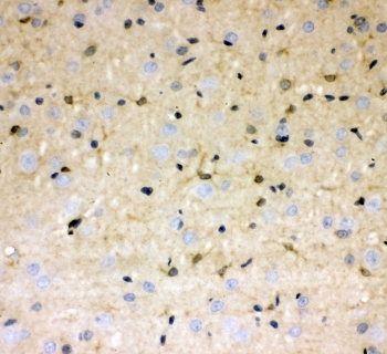 IHC staining of FFPE rat brain with DDAH1 antibody at 1ug/ml. HIER: boil tissue sections in pH6, 10mM citrate buffer, for 10-20 min followed by cooling at RT for 20 min.