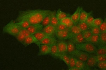 Immunofluorescent staining of FFPE human MCF7 cells with HMGB2 antibody (green) and Alpha Tubulin antibody (red). HIER: steam section in pH6 citrate buffer for 20 min.