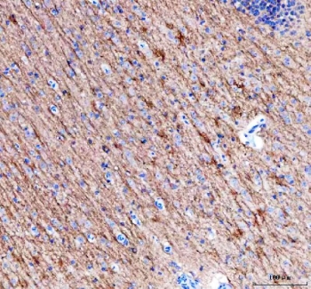 IHC staining of FFPE mouse brain tissue with Alpha Internexin antibody. HIER: boil tissue sections in pH8 EDTA for 20 min and allow to cool before testing.