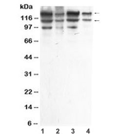 Western blot analysis of ADAR using anti-ADAR antibody. Lane 1: human HeLa whole cell lysate; Lane 2: human A549 whole cell lysate; Lane 3: human MCF-7 whole cell lysate; Lane 4: human HepG2 whole cell lysate. Adenosine deaminase acting on RNA has a predicted molecular weight of approximately 134 kDa. In these samples, ADAR is detected as two major bands migrating at approximately 150 kDa and 110 kDa, corresponding to known ADAR isoforms that differ in N-terminal length and regulatory domain composition. Differential expression of these isoforms across cell types results in variable band intensity and apparent molecular weight on SDS-PAGE.