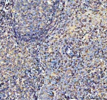 IHC staining of FFPE human tonsil tissue with AIRE antibody. HIER: boil tissue sections in pH8 EDTA for 20 min and allow to cool before testing.