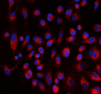 Immunofluorescent staining of FFPE human PC-3 cells with ALDH1A2 antibody (red) and DAPI nuclear stain (blue). HIER: steam section in pH6 citrate buffer for 20 min.