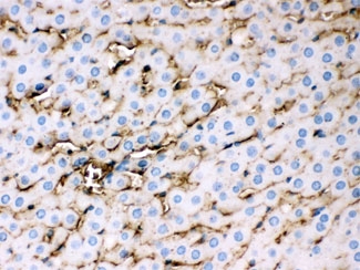 APOE Antibody Rat Liver IHC. Immunohistochemical staining of FFPE rat liver tissue with APOE antibody at 1 ug/ml. Heat-induced epitope retrieval (HIER) was performed by steaming tissue sections in pH 6 citrate buffer and allowing them to cool prior to staining. APOE immunoreactivity is observed predominantly within the cytoplasm of hepatocytes and along hepatic sinusoidal structures, consistent with the expected localization of this lipid transport protein involved in cholesterol homeostasis and lipoprotein metabolism. Cell nuclei are counterstained with hematoxylin (blue).