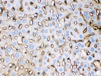 APOE Antibody Mouse Liver IHC. Immunohistochemical staining of FFPE mouse liver tissue with APOE antibody at 1 ug/ml. Heat-induced epitope retrieval (HIER) was performed by steaming tissue sections in pH 6 citrate buffer and allowing them to cool prior to staining. APOE immunoreactivity is observed predominantly within the cytoplasm of hepatocytes and along hepatic sinusoidal structures, consistent with the expected localization of this lipid transport protein involved in cholesterol homeostasis and lipoprotein metabolism. Cell nuclei are counterstained with hematoxylin (blue).