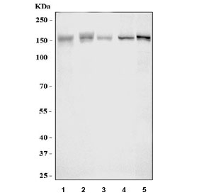 Western blot testing of 1) human K562, 2) human 293T, 3) human HepG2, 4) rat brain and 5) mouse brain lysate with BCR antibody at 0.5ug/ml. Expected molecular weight: 130-190 kDa (multiple isoforms).