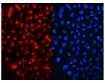 IF/ICC staining of FFPE human A431 cells with Cyclin T1 antibody (red) at 2ug/ml and DAPI nuclear stain (blue). HIER: steam section in pH6 citrate buffer for 20 min.