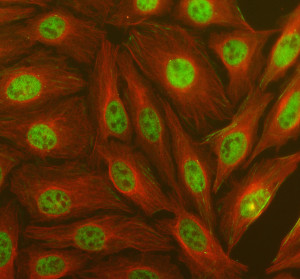 ABHD5 Antibody Immunofluorescence in HeLa Cells. Human HeLa cells were stained with ABHD5 Antibody at 5 ug/ml (green) and Alpha Tubulin Antibody (red) following enzyme-mediated antigen retrieval. ABHD5 fluorescence is concentrated predominantly in the nuclear region, with heterogeneous granular staining within the nuclei and comparatively weaker cytoplasmic signal. Alpha tubulin staining delineates the cytoplasmic microtubule network.