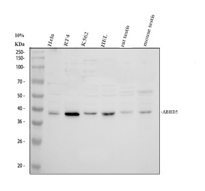 ABHD5 Antibody Western Blot in Human, Rat and Mouse Samples. Western blot testing of human HeLa (lane 1), RT4 (lane 2), K562 (lane 3), and HEL (lane 4) cell lysates, rat testis (lane 5), and mouse testis (lane 6) tissue lysates was performed with ABHD5 Antibody at 0.5 ug/ml. A predominant band is detected at approximately 39 kDa across all six samples, consistent with the expected molecular weight of ABHD5. The signal is strongest in RT4 cells, with clear detection also present in the other human, rat, and mouse samples. The results support cross-species detection using a CGI-58 Antibody.