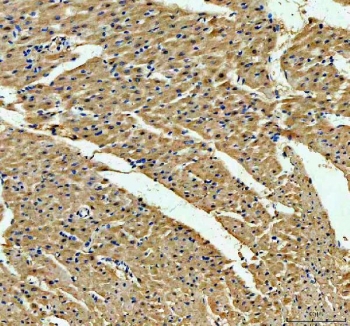 IHC staining of FFPE rat heart tissue with ACADVL antibody. HIER: boil tissue sections in pH8 EDTA for 20 min and allow to cool before testing.